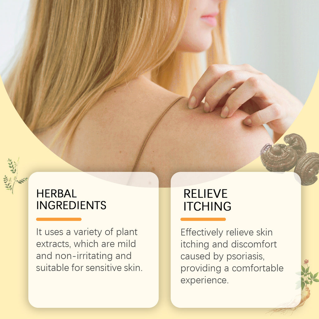 OCEAURA Herbal Psoriasis Care Soap, Soothing And Moisturizing Skin Refreshing Soap